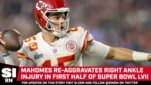 Mahomes Re-Aggravates Ankle Injury In First Half Of Super Bowl | News ...