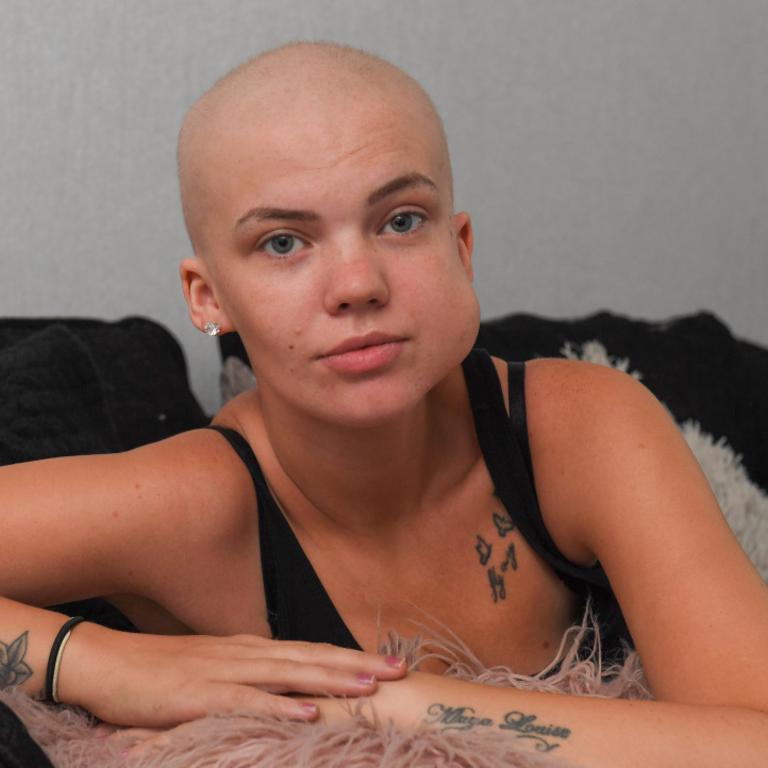 The rare cancer affected just 1 per cent of the world’s adult population. Picture: AndyKelvin / Kelvin Media