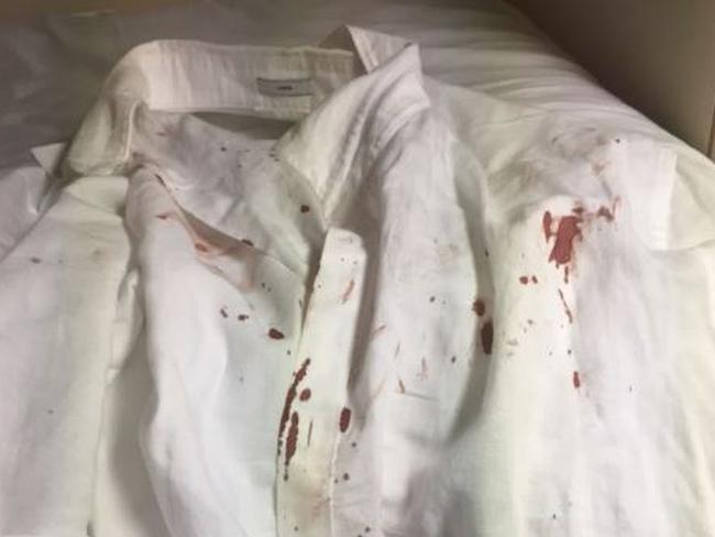 Mr Titow’s blood-soaked shirt following the fight.