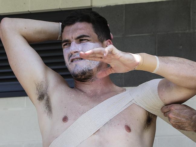 AFL - Port Adelaide training camp,  Maroochydore Queensland - Day 5 - oval training  - Tom Rockliff getting his shoulder strapped before training Picture SARAH REED