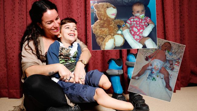 Finn Smith, pictured with mum Sarah Coureas, lost limbs during his battle with the deadly meningococcal disease. Picture: Lachie Millard