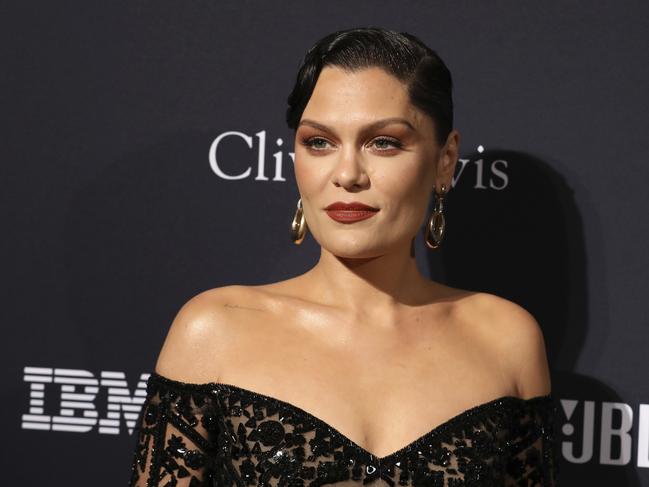 The much-loved singer is retaining her sense of humour despite her ordeal. Picture: AP