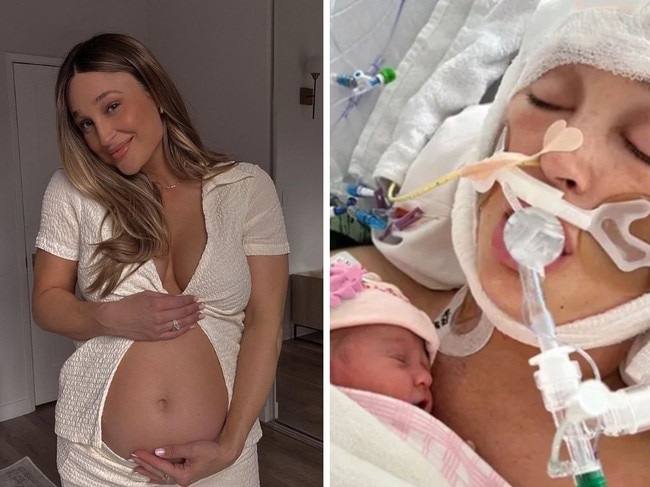 Influencer's brain burst one week before birth