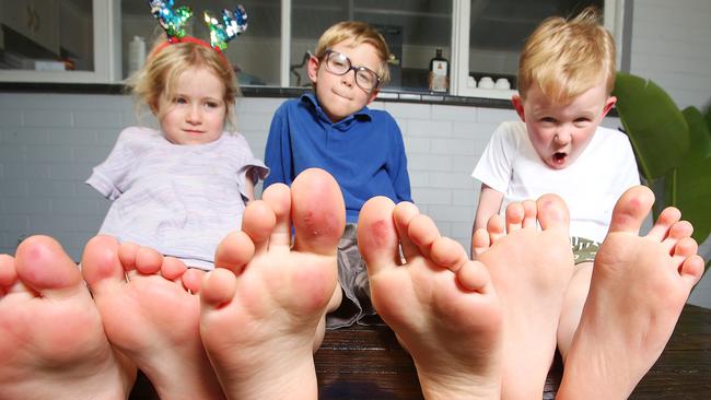 Luisa, Martin and Anderson and their sore feet. A Bell Post Hill family (Tom Higgs and four year old and six year old kids) have walked away from the ARC leisure Centre in Norlane two days in a row with bleeding feet due to the surface in the children's pool. Picture: Alan Barber