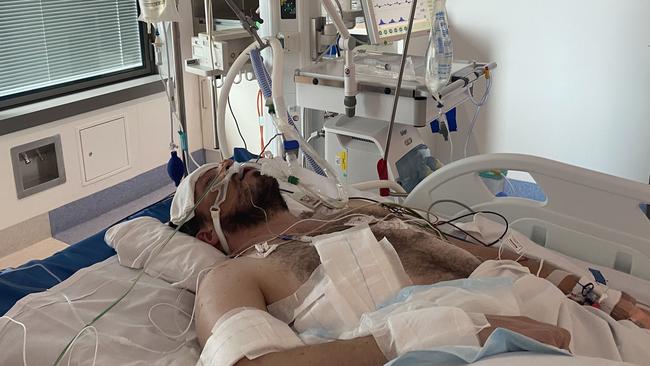 Ben suffered extensive, life-threatening injuries and spent almost three days in an induced coma at the Royal Adelaide Hospital. Picture: Tania Hyde