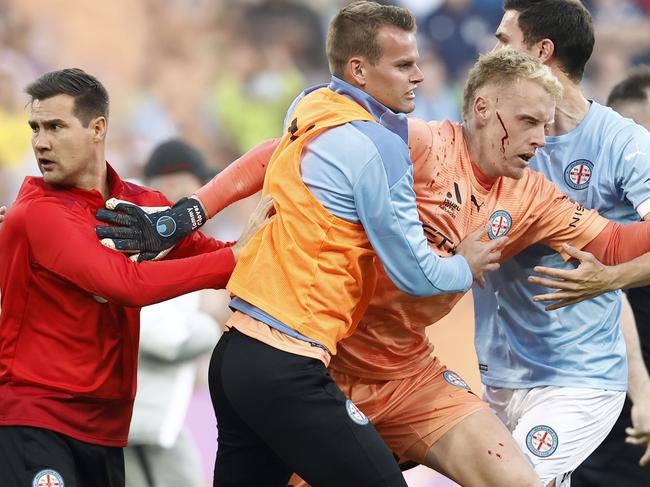 *APAC Sports Pictures of the Week - 2022, December 19* - MELBOURNE, AUSTRALIA - DECEMBER 17: A bleeding Tom Glover of Melbourne City is escorted from the pitch by team mates after fans stormed the pitch during the round eight A-League Men's match between Melbourne City and Melbourne Victory at AAMI Park, on December 17, 2022, in Melbourne, Australia. (Photo by Darrian Traynor/Getty Images)