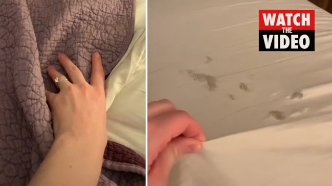 Woman's roasts husband whose toenails shredded sheets