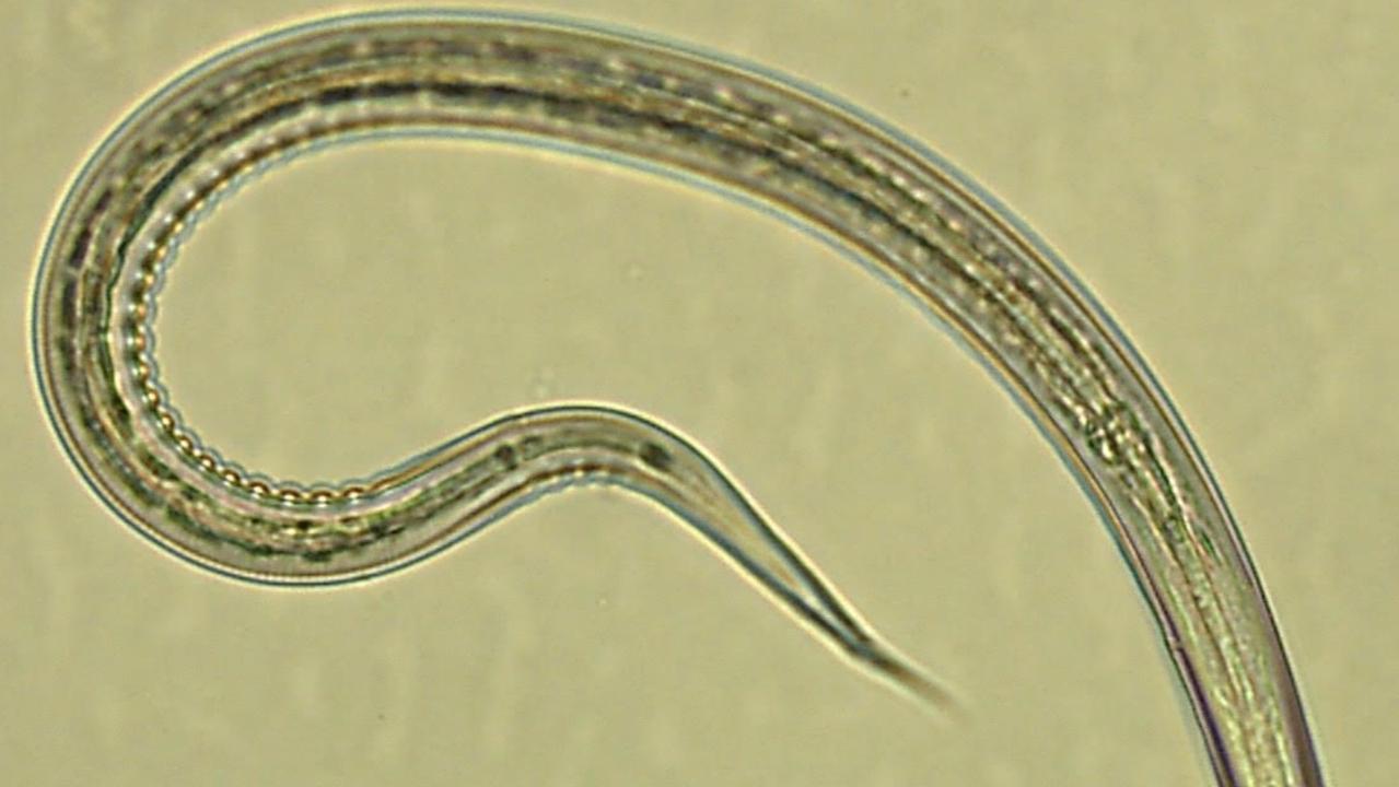 Hookworm — Science Learning Hub