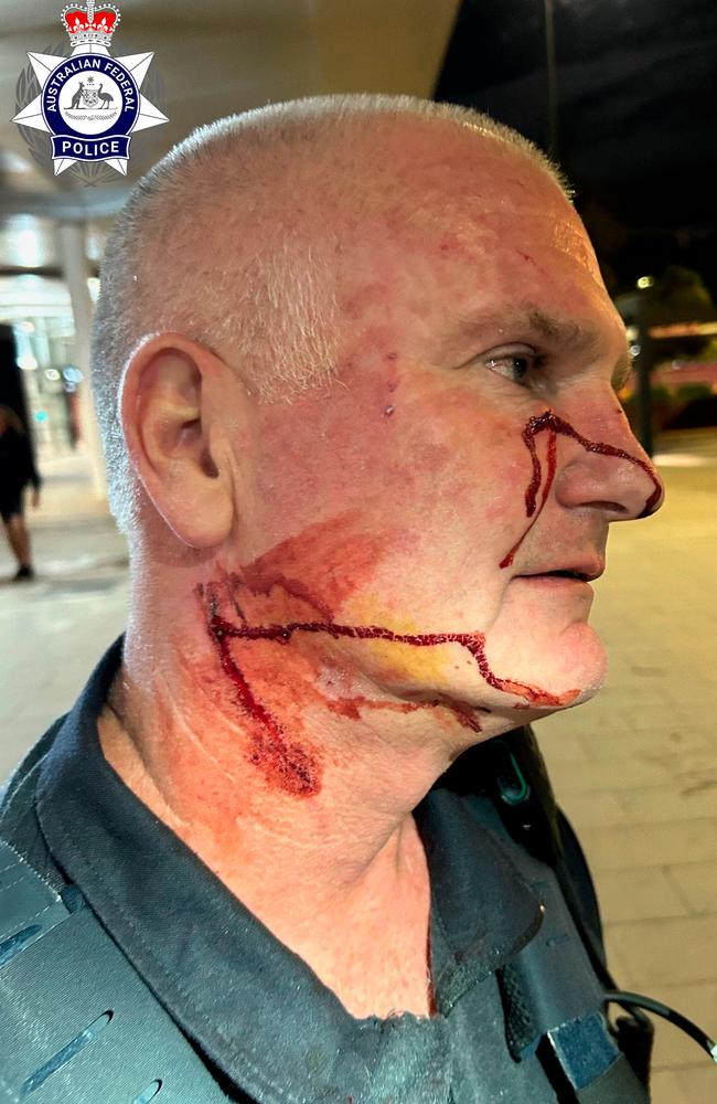 One officer was taken to a Perth Hospital following the alleged attack. Picture: AFP