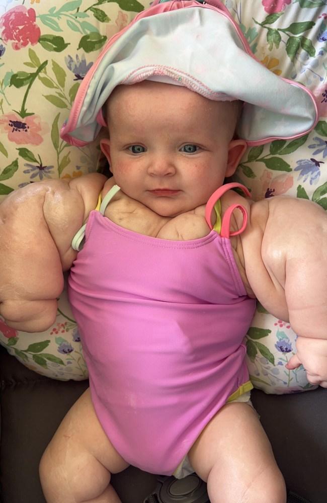 Armani has been affectionately dubbed 'baby hulk' by her loving parents. Picture: BLAKE AND CHELSEY MILBY / CATERS NEWS 