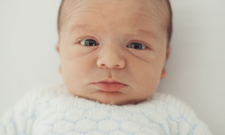 Cross-Eyed Baby: Causes and Treatment