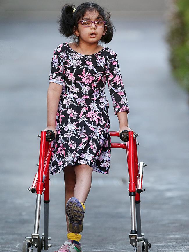 Riaa Kulkarni, 7, has a brain stem tumour, which has shrunk by 40 per cent. Picture: Ian Currie