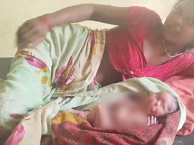 A woman stunned doctors when she gave birth to a baby with two faces, and two sets of legs and arms in India. Picture: Viral Press