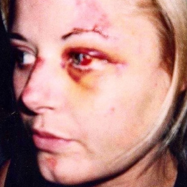 Madeleine West was hit by a bus in 2002. Picture: Instagram.