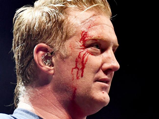 Josh Homme of Queens of the Stone Age performs with a bloody face onstage during KROQ Almost Acoustic Christmas 2017 in Los Angeles