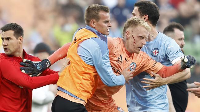 Tom Glover reacts after being struck in the face during the crowd antics. Picture: Getty Images