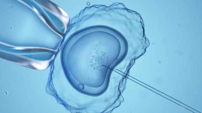 A computer illustration of in vitro fertilisation. Picture: Getty Images/The Times