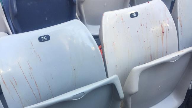 Bloodstains on the seats.