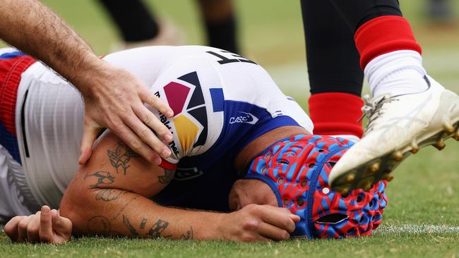 Newcastle Knights star Kalyn Ponga is facing an extended spell on the sidelines after suffering a fourth concussion in 10 months.