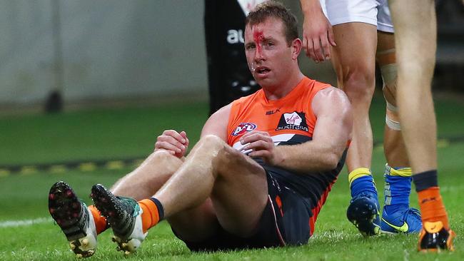 Steve Johnson ... ouch. Enough said. Picture: Phil Hillyard