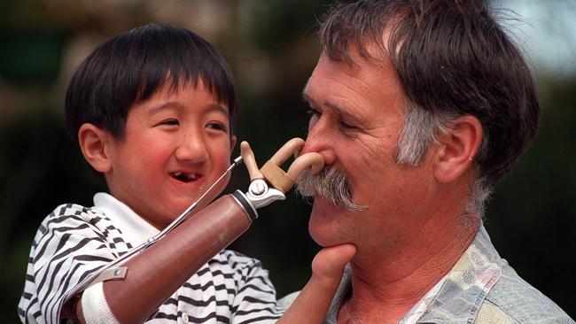 Kiri Schroeter uses his mechanical hand to pull his dad Neville's nose in 1996.