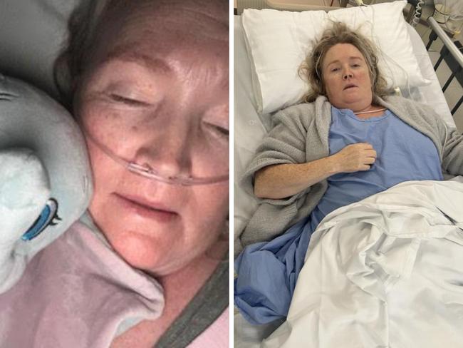 A former hairdresser in Victoria was given 'hours to live' after a 'simple' keyhole operation went dangerously wrong. Picture: Supplied