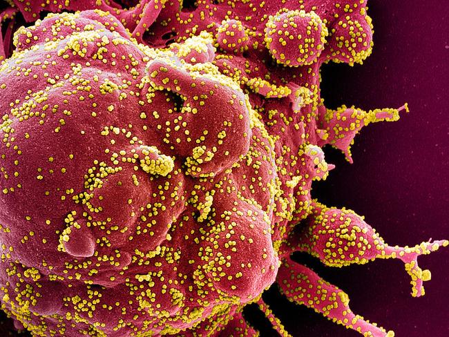 This handout image obtained on April 29, 2020 and released by the National Institute of Allergy and Infectious Diseases (NIAID) of the National Institutes of Health (NIH), shows a colorized scanning electron micrograph of an apoptotic cell (red) heavily infected with SARS-COV-2 virus particles (yellow), isolated from a patient sample captured at the NIAID Integrated Research Facility (IRF) in Fort Detrick, Maryland. - The US intelligence community said Thursday it had concluded that the novel coronavirus that has swept the globe originated in China but was not man-made or engineered. (Photo by Handout / National Institute of Allergy and Infectious Diseases / AFP) / RESTRICTED TO EDITORIAL USE - MANDATORY CREDIT "AFP PHOTO / NATIONAL INSTITUTE OF ALLERGY AND INFECTIOUS DISEASES, NIH " - NO MARKETING - NO ADVERTISING CAMPAIGNS - DISTRIBUTED AS A SERVICE TO CLIENTS