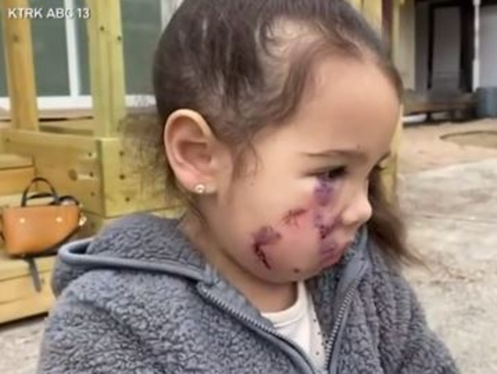 Ronin Waldroup, 3, was walking into a restaurant with her family when a dog suddenly attacked her. Picture: KTRK ABC 13