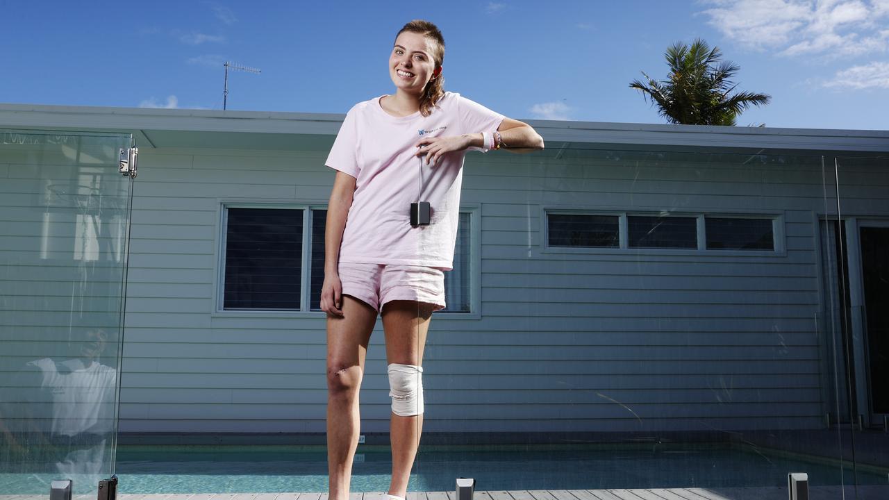 111 days after being told she most likely wouldn't survive a traumatic brain injury sustained in a bicycle crash in Pomona, 20 year old triathlete Alexa Leary returns to her family home in Noosaville after 4 months in hospital. Picture Lachie Millard