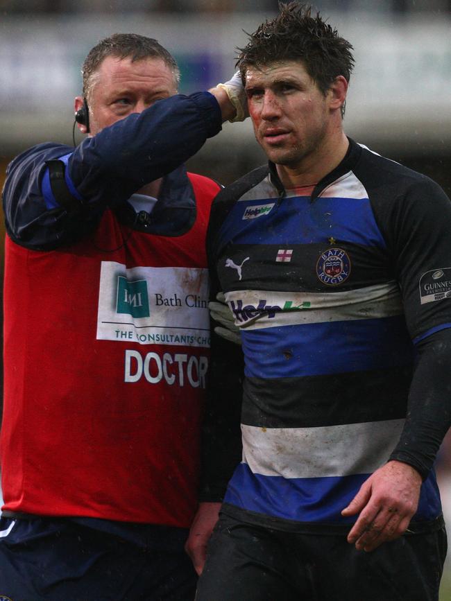 Being treated after a heavy clash in 2009. Picture: Getty