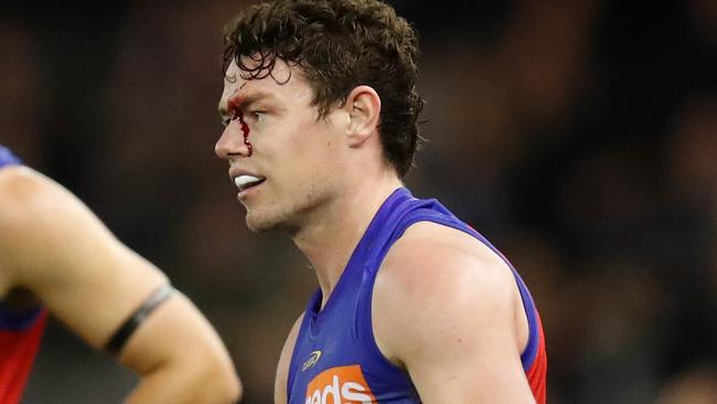 A bloodied Lachie Neale touched an umpire after an accidental scratch from Patrick Cripps. Picture: Michael Willson/AFL Photos/Getty Images