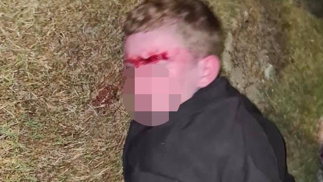 A teenager allegedly behind a Logan crime spree was beaten by residents who caught him in the act. Picture: Crime Watch Logan