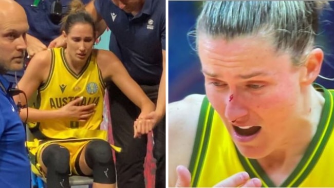 Bec Allen and Sami Whitcomb were battered and bruised.