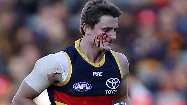 Matt Crouch runs off after copping a boot to the face. Picture: Sarah Reed