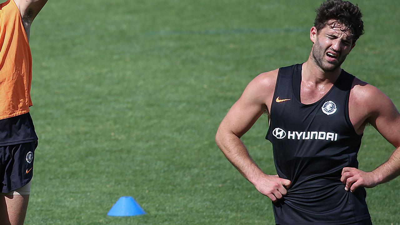 Alex Fasolo broke his arm in a wrestle with a friend. Picture: Ian Currie