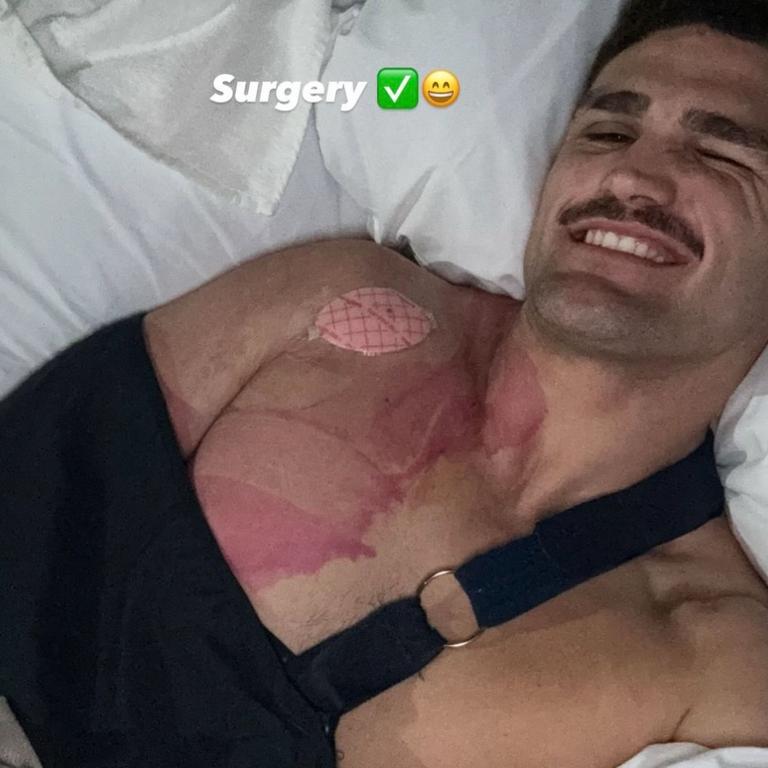 Nathan Cleary is recovering from shoulder surgery. Picture: Instagram