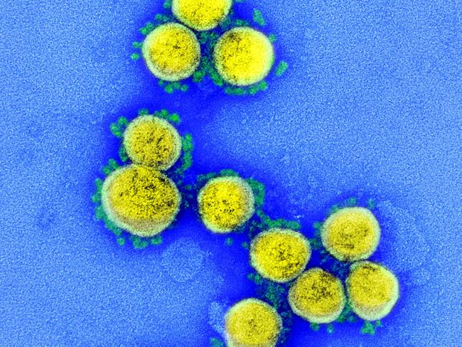 This undated handout image obtained August 11, 2020, courtesy of the National Institute of Allergy and Infectious Diseases(NIH/NIAID), shows a ransmission electron micrograph of SARS-CoV-2 virus particles, isolated from a patient, captured and color-enhanced at the NIAID Integrated Research Facility (IRF) in Fort Detrick, Maryland. - Although none of the coronavirus vaccines under development has proved its efficacy yet in clinical trials, at least 5.7 billion doses have been pre-ordered around the world. First shipments of a COVID-19 vaccine created by Western laboratories have often been snapped up by the United States.Five vaccines -- three Western and two Chinese -- are in Phase 3 efficacy trials involving thousands of people.In a surprise announcement, Russian President Vladimir Putin claimed on August 11, 2020 that a vaccine dubbed "Sputnik V" -- after the Soviet satellite -- conferred "sustainable immunity" against the novel coronavirus. (Photo by Handout / National Institute of Allergy and Infectious Diseases / AFP) / RESTRICTED TO EDITORIAL USE - MANDATORY CREDIT "AFP PHOTO /NATIONAL INSTITUTE OF ALLERGY AND INFECTIOUS DISEASES/HANDOUT " - NO MARKETING - NO ADVERTISING CAMPAIGNS - DISTRIBUTED AS A SERVICE TO CLIENTS