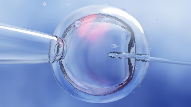 IVF (in vitro fertilization) or insemination of female egg with microscope