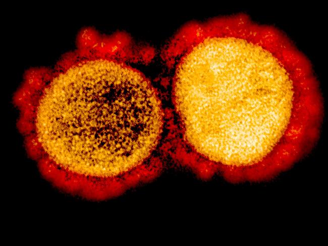 (FILES) In this file undated handout image obtained August 11, 2020, courtesy of the National Institute of Allergy and Infectious Diseases(NIH/NIAID), shows a transmission electron micrograph of SARS-CoV-2 virus particles, isolated from a patient,captured and color-enhanced at the NIAID Integrated Research Facility (IRF) in Fort Detrick, Maryland. - The US biotech firm Eli Lilly on October 7, 2020 announced it was seeking an emergency use authorization (EUA) for its lab-produced antibody treatments against Covid-19, after early trial results showed they reduced viral load, symptoms and hospitalization rates."Our teams have worked tirelessly the last seven months to discover and develop these potential antibody treatments," said Daniel Skovronsky, Lilly's chief scientific officer. (Photo by Handout / National Institute of Allergy and Infectious Diseases / AFP) / RESTRICTED TO EDITORIAL USE - MANDATORY CREDIT "AFP PHOTO /NATIONAL INSTITUTE OF ALLERGY AND INFECTIOUS DISEASES/HANDOUT " - NO MARKETING - NO ADVERTISING CAMPAIGNS - DISTRIBUTED AS A SERVICE TO CLIENTS