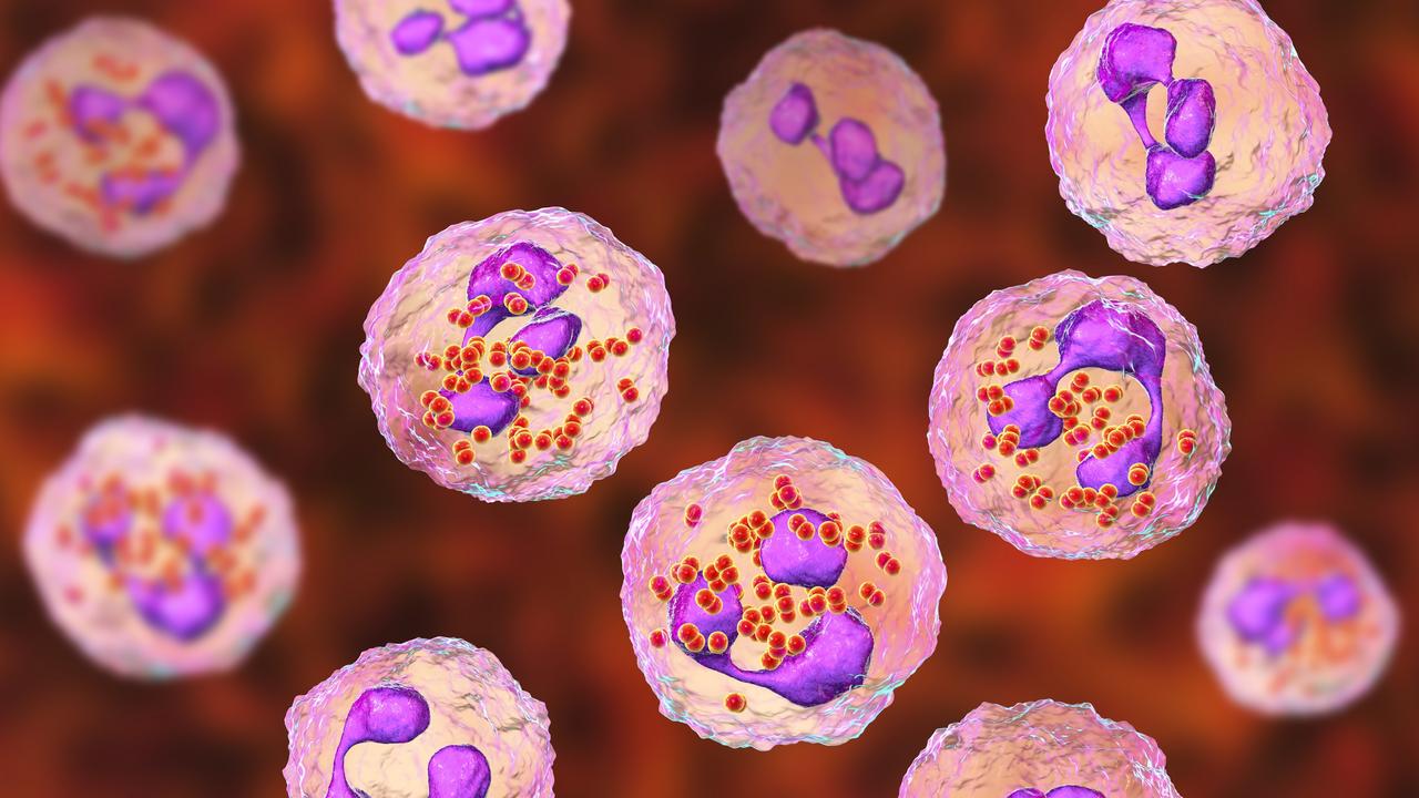 Meningococcal meningitis, cerebrospinal fluid smear containing neutrophils with and without bacteria Neisseria meningitidis, 3D illustration