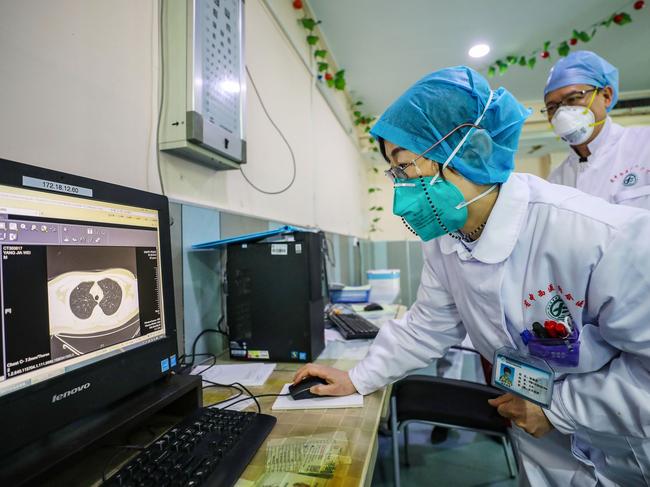 A doctor in Wuhan looks at a lung CT image from a patient in late January. Picture: AFP