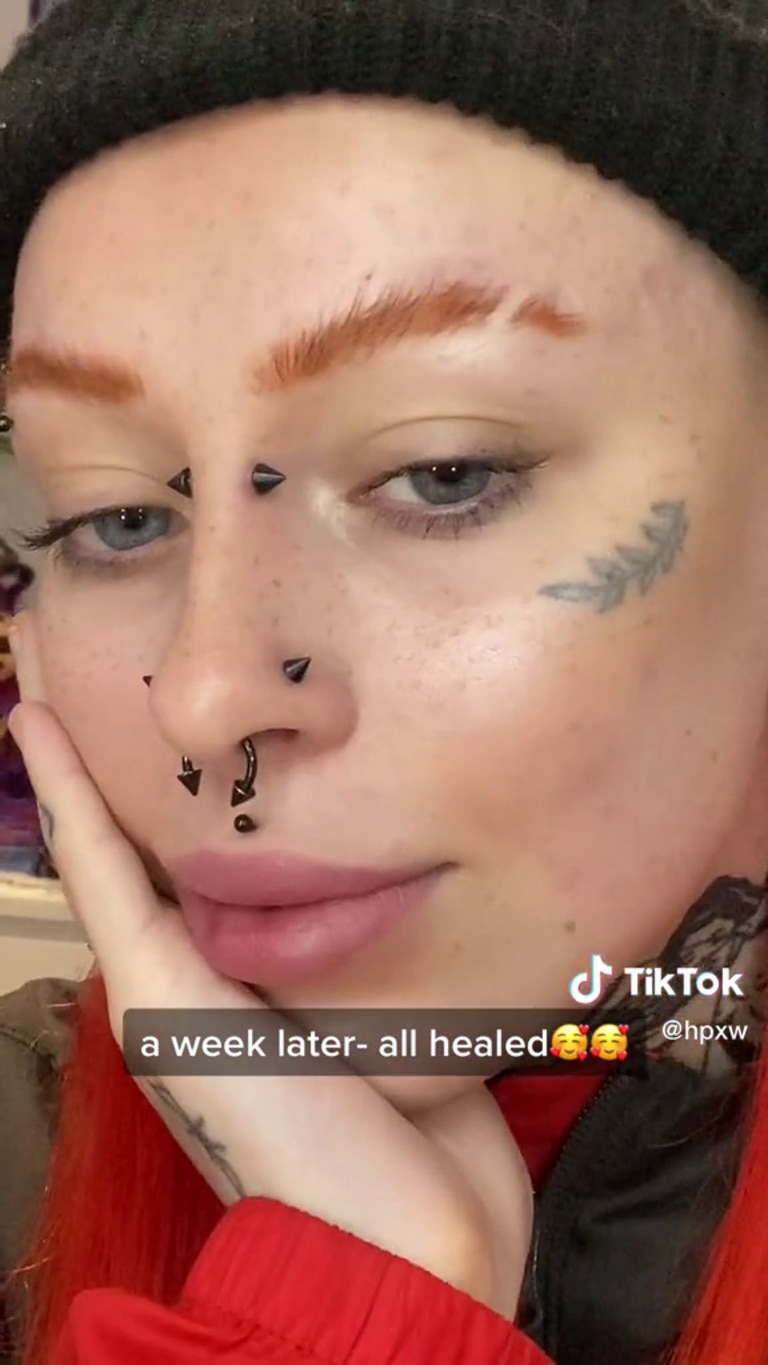 Hollie confirmed she had been “getting lip filler since 2019” resulting in “a lot of build up.” Picture: @hpxw