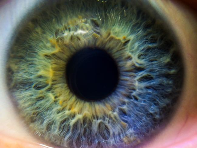 The retina is a thin layer of cells at the back of the eye responsible for detecting light and converting it into an electrical signal and sending it to the brain to interpret as an image. Picture: iStock