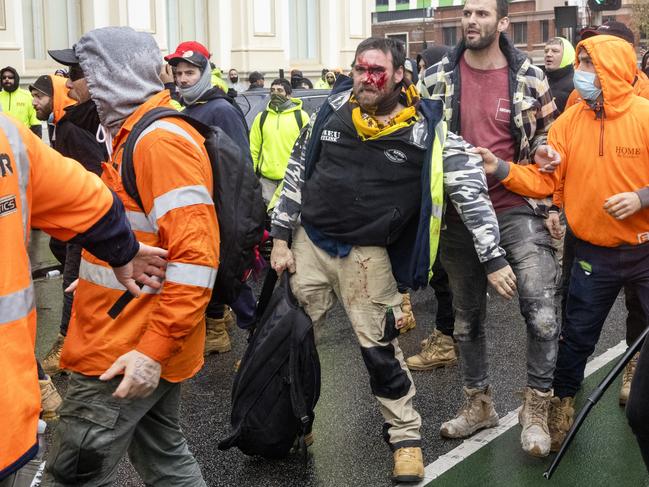 A construction worker sustains injuries after violence erupts. Picture: David Geraghty