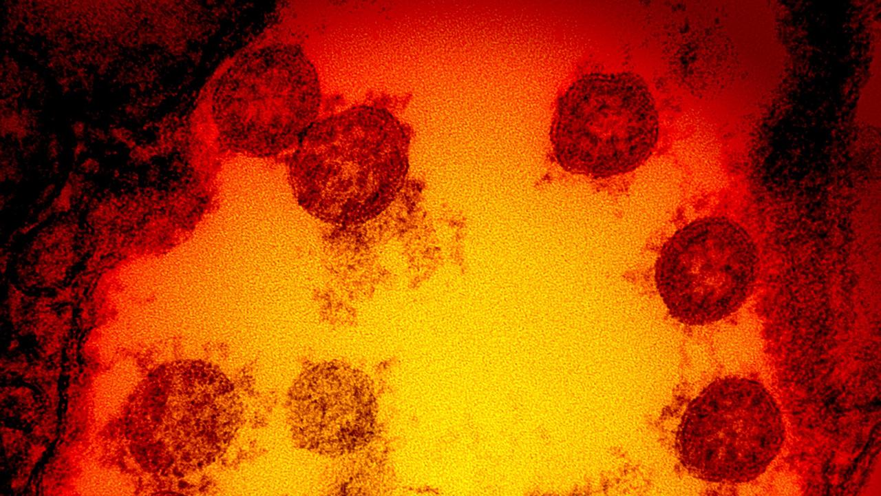 A transmission electron micrograph of SARS-CoV-2 virus particles, isolated from a patient. Picture: AFP