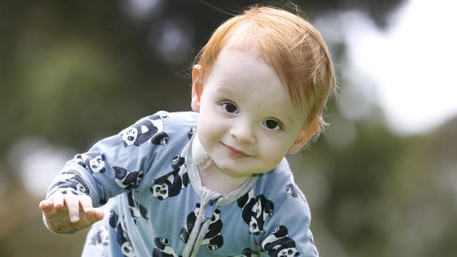 Samuel Edwards, one, has an under developed lower bowl condition. Picture: David Caird