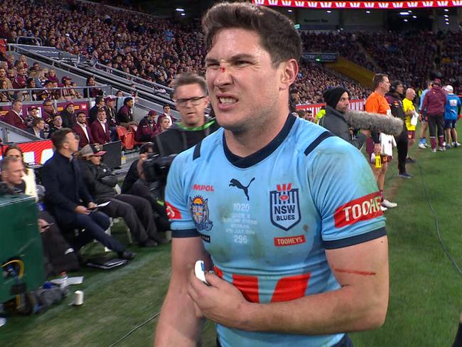 Mitch Moses suffered a bicep injury in Origin III.