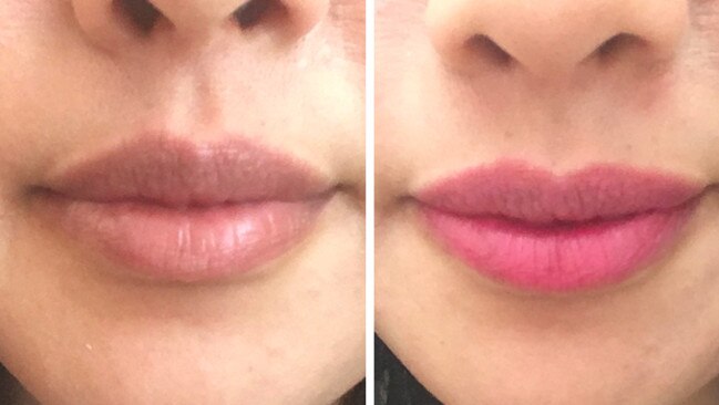 Carla's lips, before and after. Picture: Supplied