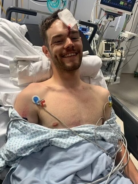 English cyclist Matt Walls shares a photo from his hosptal bed days after a freak accident left him unconscious