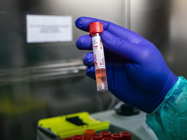 MILAN, ITALY - MARCH 05: A lab worker handles a vial during a swab test process in the Molecular biology laboratory of the Ospedale Niguarda, on March 05, 2020 in Milan, Italy. Over 3,089 people have been infected by the novel Coronavirus in Italy. Among these 107 people have died, (mainly because of a previous and serious clinical conditions compromised by the virus) 2,706 people have currently tested positive and 276 people have recovered, making Italy the hub of the epidemic in the west and pushing the Italian Government to issue extreme safety measures. (Photo by Emanuele Cremaschi/Getty Images)